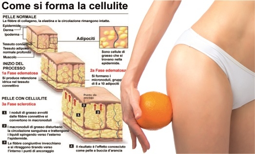 cellulite.jpg