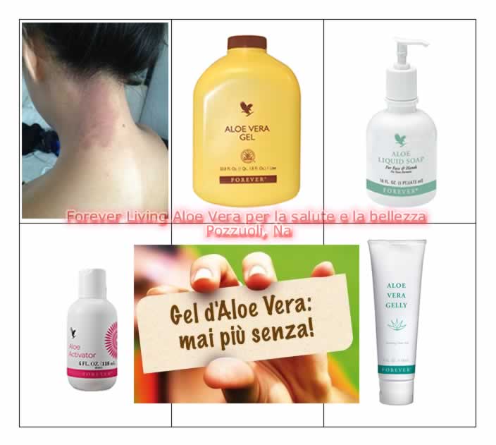 L'eczema: consigli di intervento da Forever Living