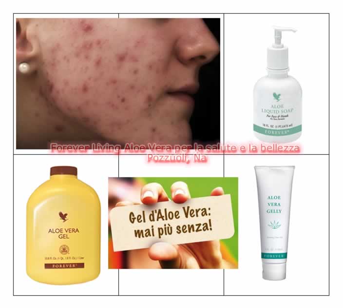 L'acne: consigli di intervento da Forever Living