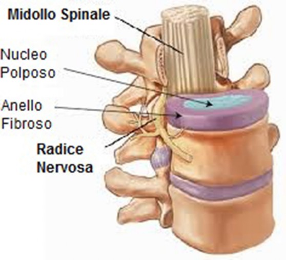 rachide-disco-intervertebrale-GRA.jpg